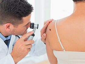 The doctor examines the papilloma and recommends its removal with medication
