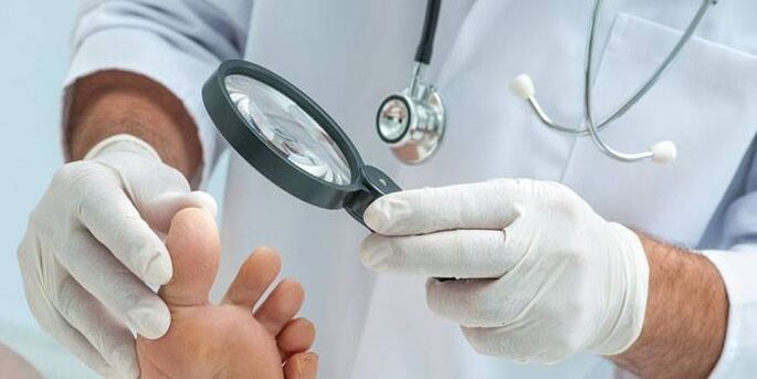 The doctor examines the foot with warts on the foot